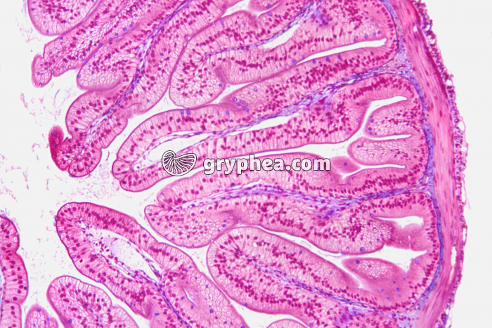 Intestin grêle CT x40 - gryphea.org